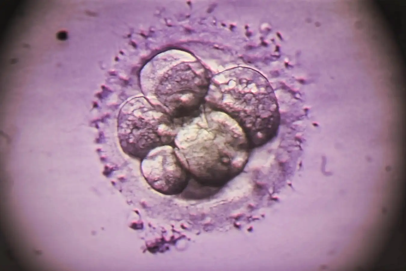Standard IVF Tests Overlook Certain Genetic Abnormalities in Embryos