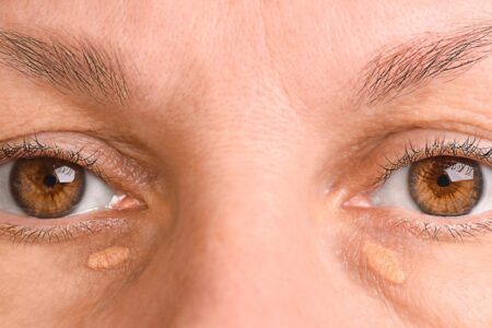 Many Individuals Carrying the High Cholesterol Gene Are Unaware Study