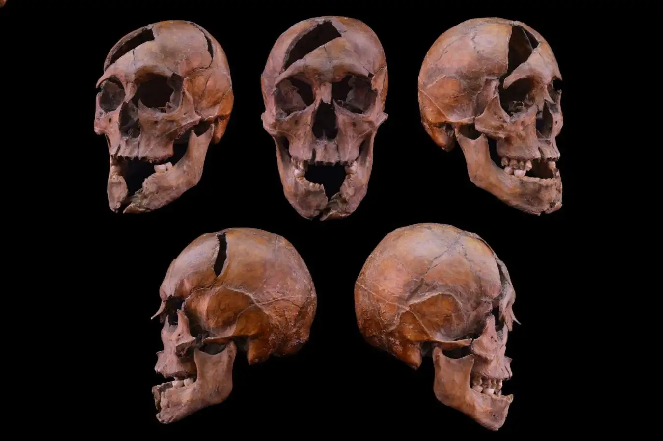 Skeleton of Duke Assassinated in 1272 Revealed to Bear Brutal