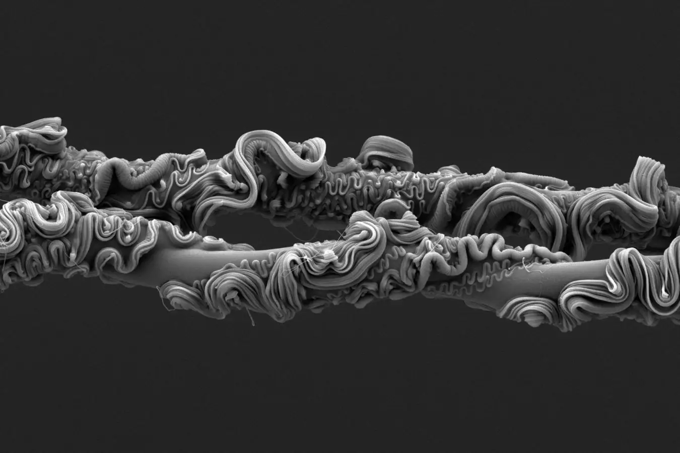 Stunning Close Up of Spider Silk Earns Scientific Photography Award