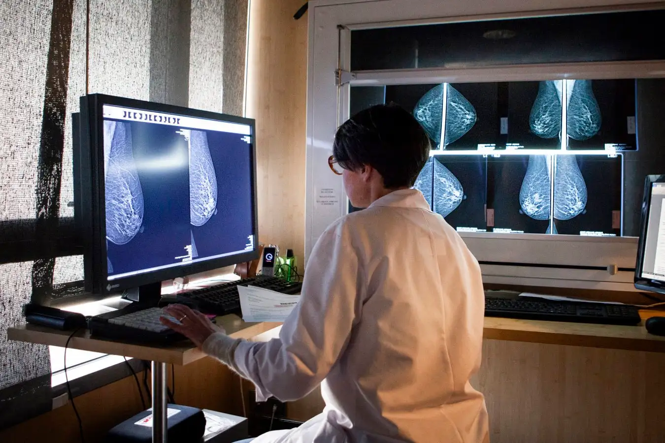 AI-Enhanced Mammograms Lower Risk of Malignant Breast Cancer AI Enhanced Mammograms Lower Risk of Malignant Breast Cancer
