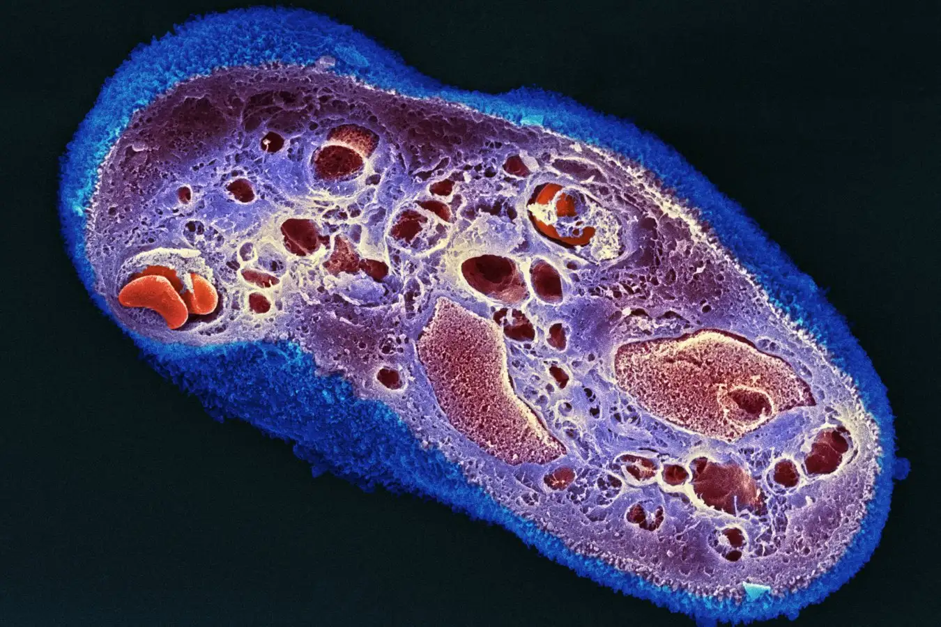 How Dried Placenta Strips Promote Wound Healing and Minimize Scarring