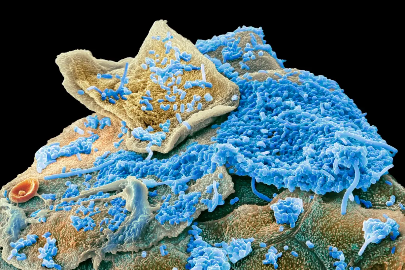 Impact of Abnormal Oral Microbiome on Obesity Key Characteristics and