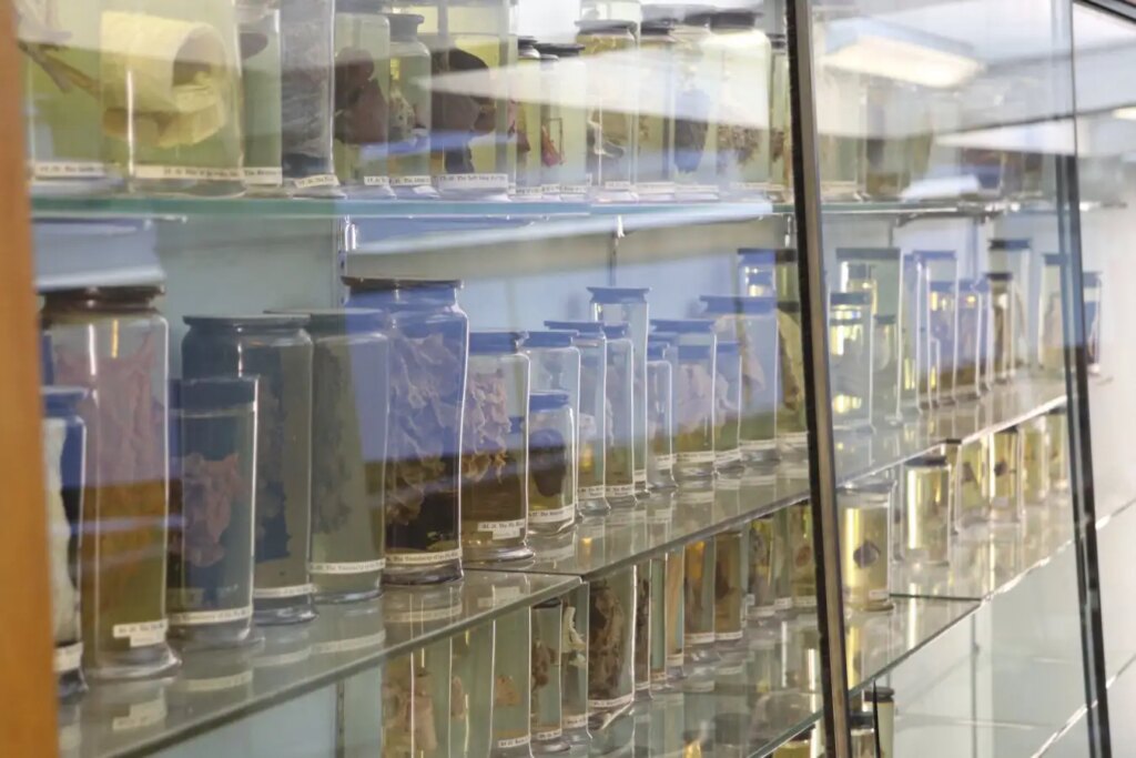 Ancient Cold Virus Discovered in 18th Century Woman’s Lungs: Insights into the World’s Oldest Pathogen Ancient Cold Virus Discovered in 18th Century Womans Lungs Insights