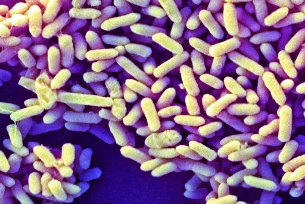 Comparing the Western Infant Microbiome to Global Infant Microbiomes Key