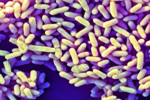 Comparing the Western Infant Microbiome to Global Infant Microbiomes Key