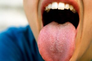 Debunking the Biggest Myths About the Human Tongue What You