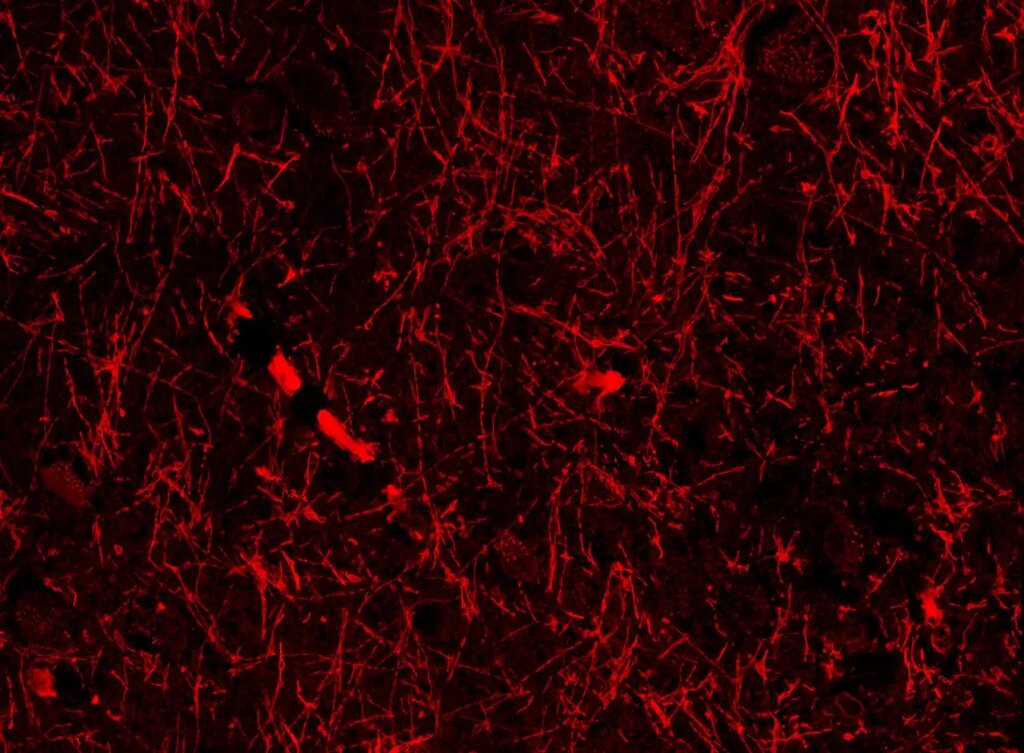 Unexpected Discovery Unveils Mysterious Brain Structure