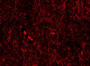 Unexpected Discovery Unveils Mysterious Brain Structure