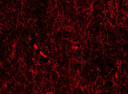 Unexpected Discovery Unveils Mysterious Brain Structure Unexpected Discovery Unveils Mysterious Brain Structure