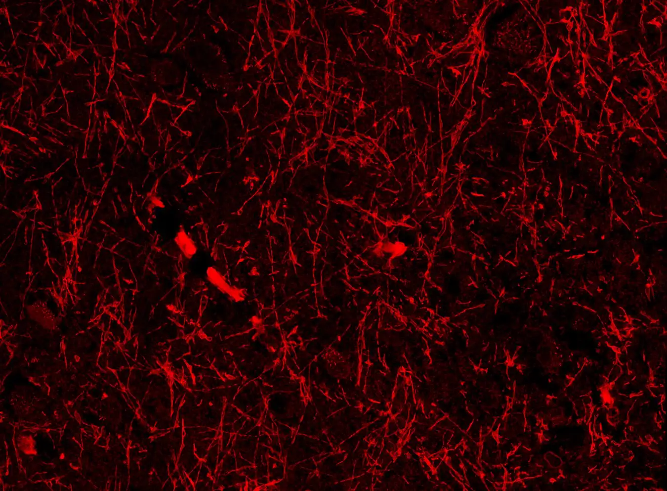 Unexpected Discovery Unveils Mysterious Brain Structure