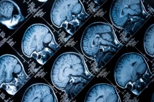 Why Personalized Medicine Isnt Here Yet and How We Can