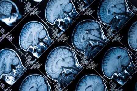 Why Personalized Medicine Isnt Here Yet and How We Can