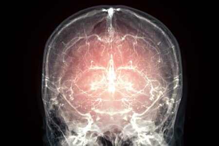 Breakthrough in Mammal Brain Preservation: A Major Step Towards Resuscitation After Death Breakthrough in Mammal Brain Preservation A Major Step Towards Resuscitation