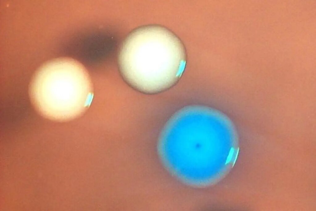 Creating ‘Zombie’ Cells: Transplanting Genomes into Dead Bacteria for Innovative Research Creating Zombie Cells Transplanting Genomes into Dead Bacteria for Innovative