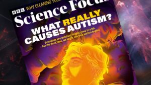 Uncovering the True Causes of Autism: What You Need to Know Uncovering the True Causes of Autism What You Need to