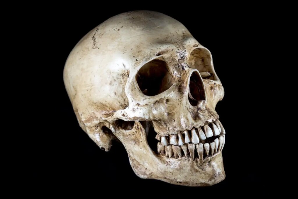 Evolution of Human Head Shape Significant Changes Over the Last