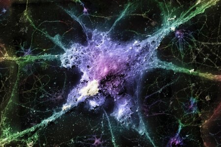 Promising New Method for Eliminating Brain Waste in Alzheimers Disease