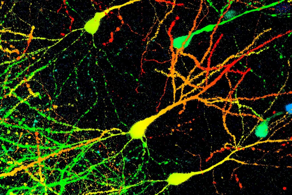 Unlocking the Secrets of ‘Compound X’: A Breakthrough in Eliminating Parkinson’s Disease Proteins from the Brain Unlocking the Secrets of Compound X A Breakthrough in Eliminating