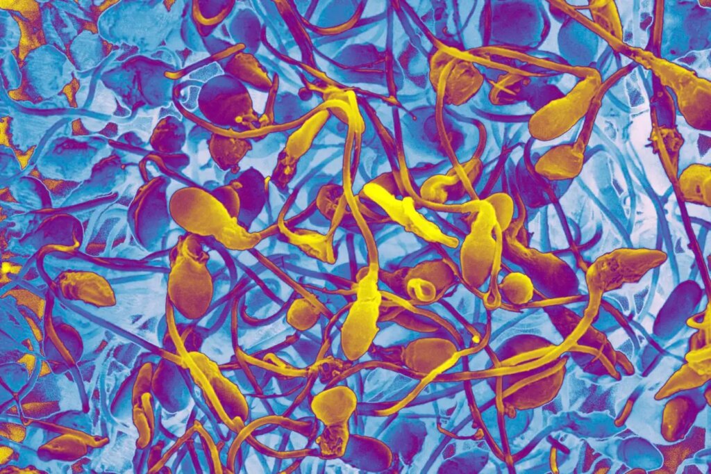 Can Lab-Grown Sperm Help Infertile Men Become Fathers? Can Lab Grown Sperm Help Infertile Men Become Fathers