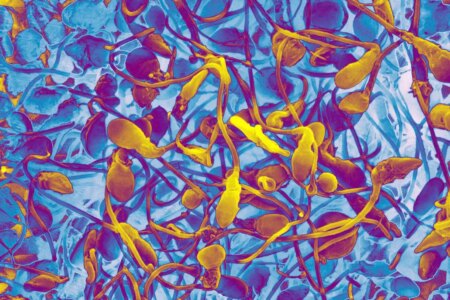 Can Lab-Grown Sperm Help Infertile Men Become Fathers? Can Lab Grown Sperm Help Infertile Men Become Fathers