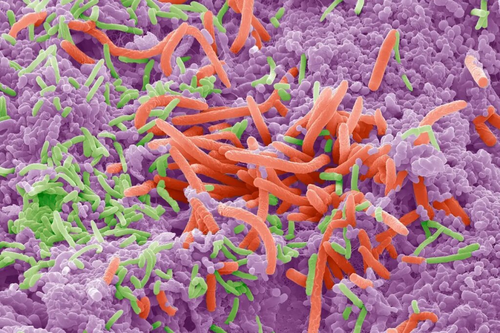 How the Oral Microbiome Affects Weight Management Liver Health and