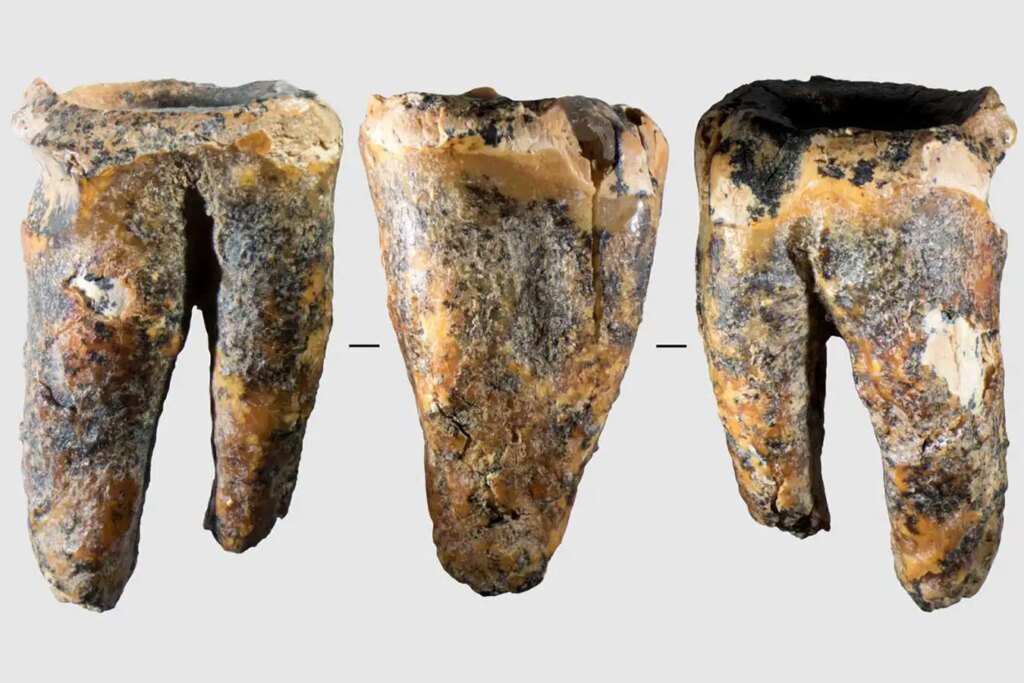 Neanderthals’ Advanced Dental Care: How They Drilled Holes in Teeth to Treat Cavities Neanderthals Advanced Dental Care How They Drilled Holes in Teeth
