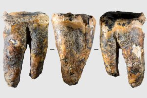 Neanderthals Advanced Dental Care How They Drilled Holes in Teeth