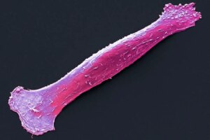 Revitalizing Aging Muscles How Rebooting Stem Cells Accelerates Injury Recovery
