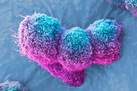 Revolutionary Viral Injections Stop Pancreatic Cancer Progression in Three Patients