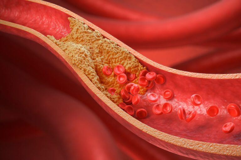 Unexpected Cholesterol Lowering Supplements You Might Already Be Taking