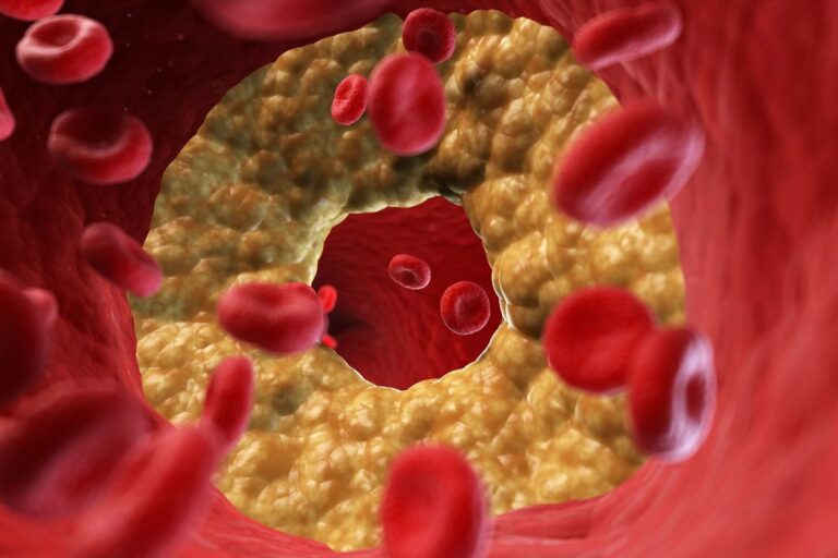 Are Keto Dieters Facing a Cholesterol Crisis Explore the Risks