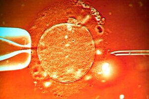 How Magnetic Sperm Enhances In Vitro Fertilization Success