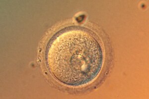 Is Gene Editing of Babies Now Safe Exploring the Latest