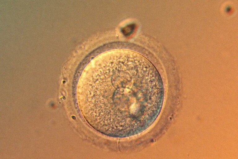 Is Gene Editing of Babies Now Safe Exploring the Latest