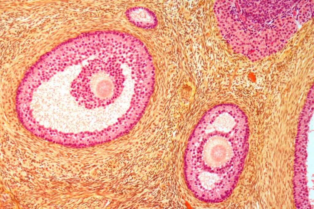Enhancing Fertility How Softening the Ovaries Can Improve Reproductive Health
