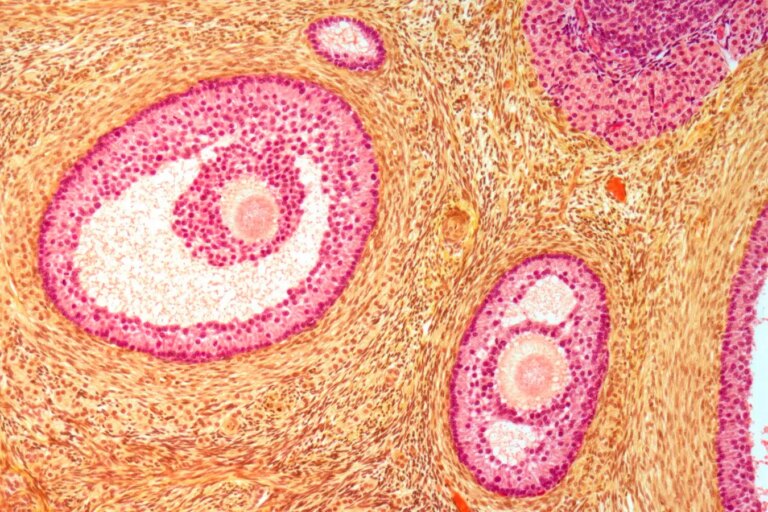 Enhancing Fertility How Softening the Ovaries Can Improve Reproductive Health