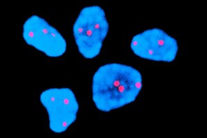 New Injection Reduces Chromosomal Errors in Older Womens Eggs by