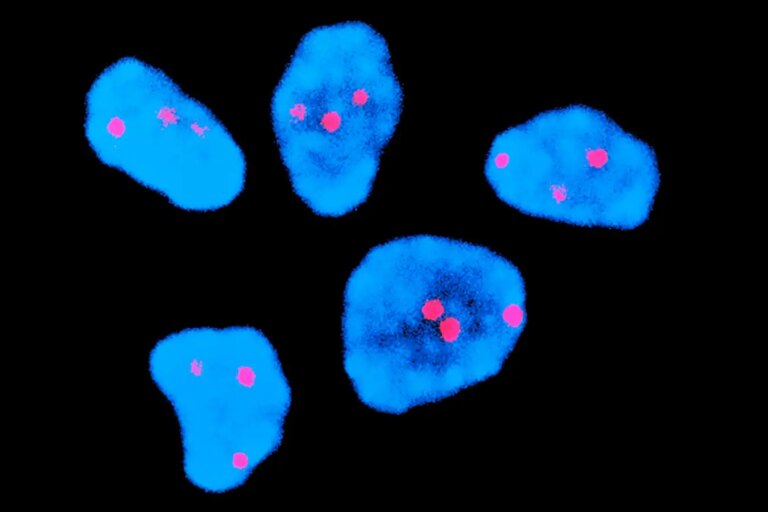 New Injection Reduces Chromosomal Errors in Older Womens Eggs by