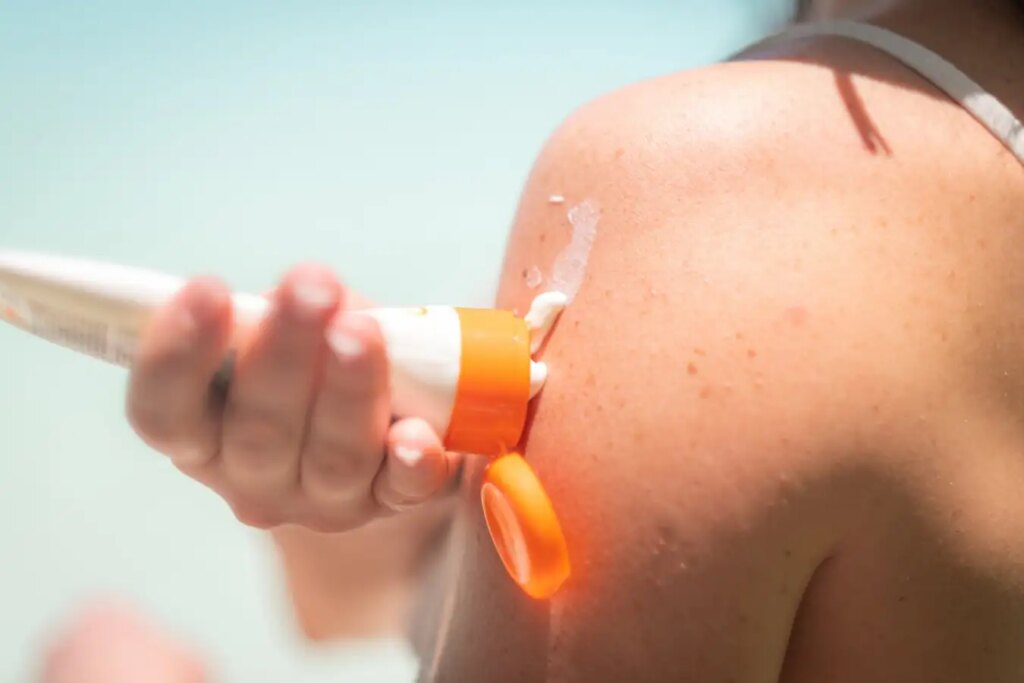 Top 5 Essential Sunscreen Tips from a Skin Cancer Expert