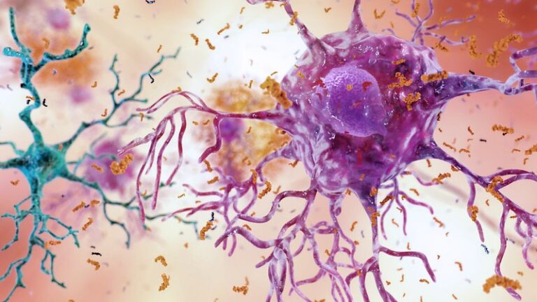 How DNA damage can lead to neurodegenerative diseases – Sciworthy