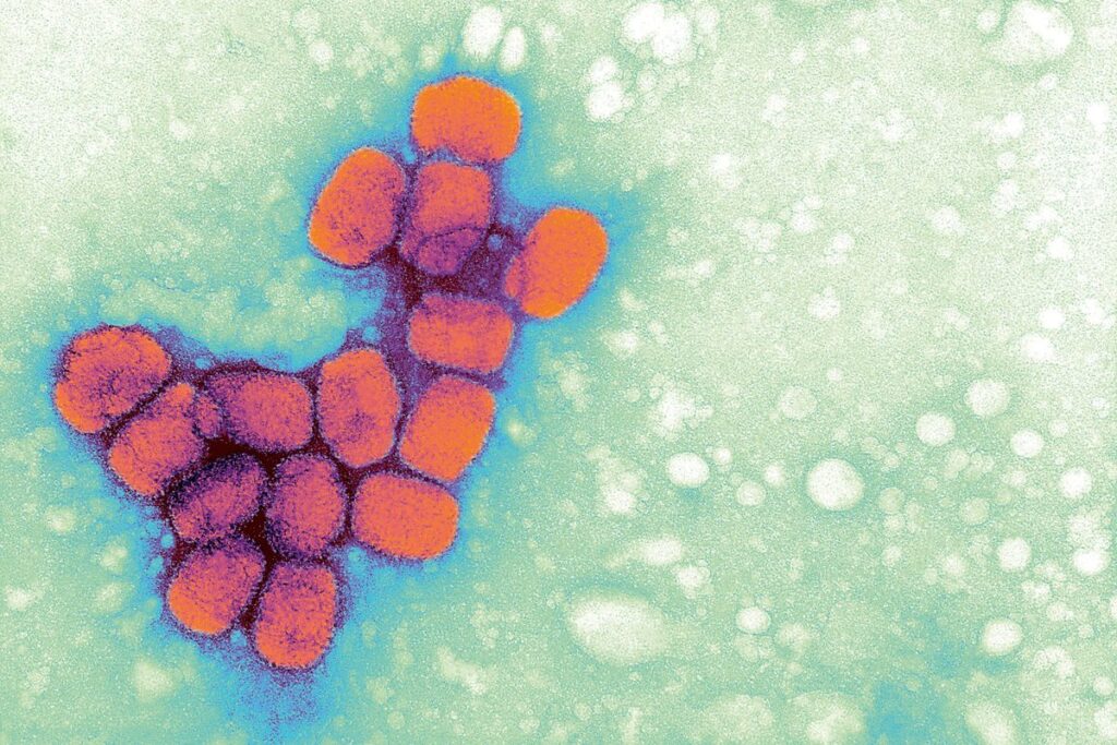 Uncovered: Six Previously Overlooked Smallpox Samples Discovered in US Laboratory – Unveiling the Possibility of More Unknown Samples Uncovered Six Previously Overlooked Smallpox Samples Discovered in US Laboratory