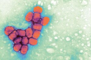 Uncovered: Six Previously Overlooked Smallpox Samples Discovered in US Laboratory – Unveiling the Possibility of More Unknown Samples Uncovered Six Previously Overlooked Smallpox Samples Discovered in US Laboratory