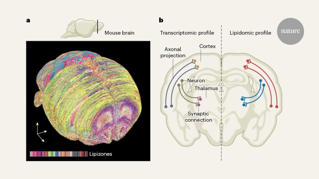Brain Lipids Organized into Zones and Reorganized During Pregnancy