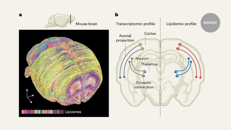 Brain Lipids Organized into Zones and Reorganized During Pregnancy
