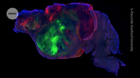 Human Brain Cells Transplanted into Mice in Most Extensive Integration