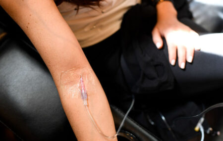 IV Drops Used for Detoxification Filled with Toxins Leading to