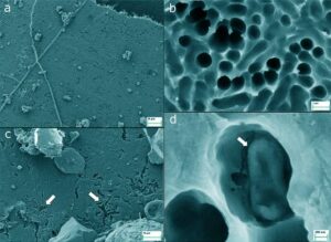 New Discovery Soil Bacterial Enzyme capable of Degrading Plastics and