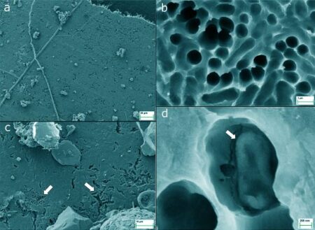 New Discovery Soil Bacterial Enzyme capable of Degrading Plastics and