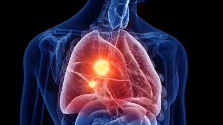 New Mesothelioma Drug Boosts Cancer Defense Mechanisms New Mesothelioma Drug Boosts Cancer Defense Mechanisms